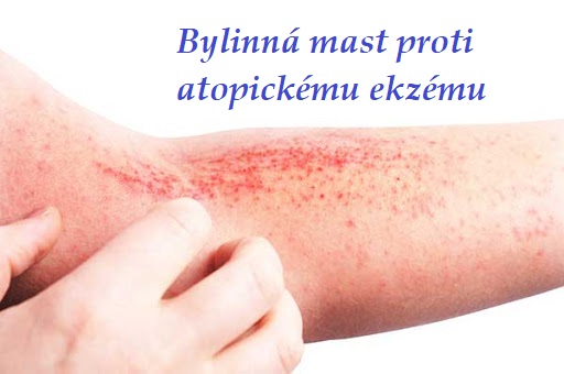 Mast proti atopickému ekzému - suroviny, postup výroby