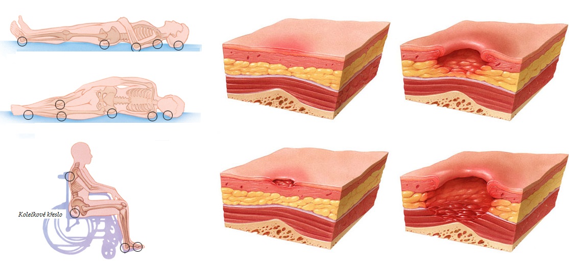 prolezeniny byliny bylinky babske rady